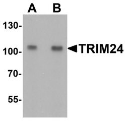 Invitrogen TRIM24 Polyclonal Antibody 100 &mu;g; Unconjugated:Antibodies,
