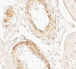 Invitrogen GOLGA5 Polyclonal Antibody 100 &mu;g; Unconjugated:Antibodies,