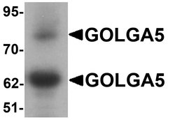 Invitrogen GOLGA5 Polyclonal Antibody 100 &mu;g; Unconjugated:Antibodies,