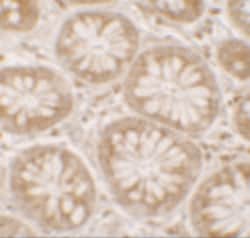 Invitrogen DAP Polyclonal Antibody 100 μg; Unconjugated:Antibodies,