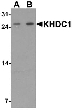 Invitrogen KHDC1 Polyclonal Antibody 100 &mu;g; Unconjugated:Antibodies,
