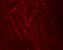 Invitrogen FGFR3 Polyclonal Antibody 100 &mu;g | Buy Online | Invitrogen&trade; | Fisher Scientific