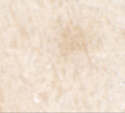 Invitrogen&trade;&nbsp;FGFR3 Polyclonal Antibody