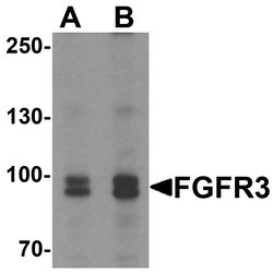 Invitrogen FGFR3 Polyclonal Antibody 100 &mu;g | Buy Online | Invitrogen&trade; | Fisher Scientific