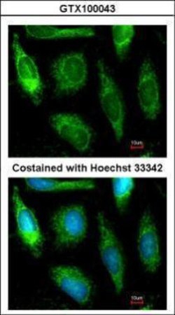 Invitrogen ALDH1A1 Polyclonal Antibody 100 &mu;L; Unconjugated:Antibodies,