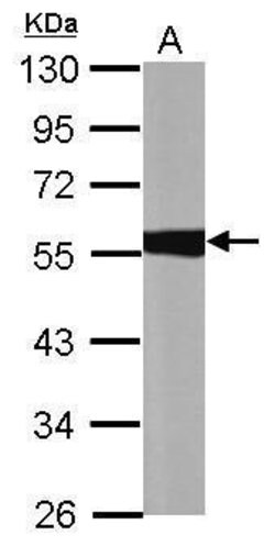 Invitrogen ALDH1A1 Polyclonal Antibody 100 &mu;L; Unconjugated:Antibodies,