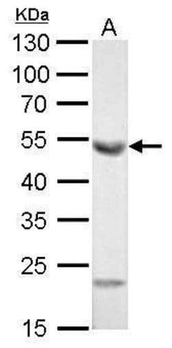 Invitrogen ALDH1A1 Polyclonal Antibody 100 &mu;L; Unconjugated:Antibodies,