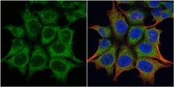 TRIM23 Polyclonal Antibody, Invitrogen 100 &mu;L; Unconjugated:Antibodies,