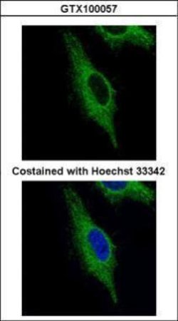TRIM23 Polyclonal Antibody, Invitrogen 100 &mu;L; Unconjugated:Antibodies,