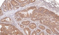 TRIM23 Polyclonal Antibody, Invitrogen 100 &mu;L; Unconjugated:Antibodies,