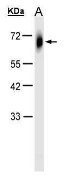 TRIM23 Polyclonal Antibody, Invitrogen 100 &mu;L; Unconjugated:Antibodies,