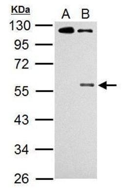 Invitrogen Phospho-CHK1 (Ser345) Polyclonal Antibody 100 &mu;L; Unconjugated:Antibodies,