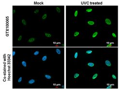 Invitrogen Phospho-CHK1 (Ser345) Polyclonal Antibody 100 &mu;L; Unconjugated:Antibodies,