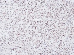 Invitrogen Chk1 Polyclonal Antibody 100 &mu;L; Unconjugated:Antibodies,