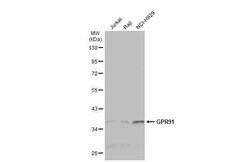 Invitrogen GPR91 Polyclonal Antibody 100 &mu;L; Unconjugated:Antibodies,