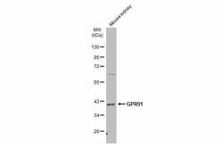 Invitrogen GPR91 Polyclonal Antibody 100 &mu;L; Unconjugated:Antibodies,
