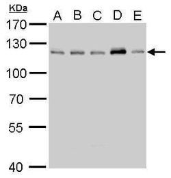 Invitrogen CYLD Polyclonal Antibody 100 &mu;L; Unconjugated:Antibodies,