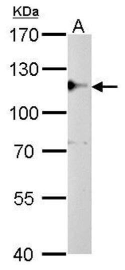 Invitrogen CYLD Polyclonal Antibody 100 &mu;L; Unconjugated:Antibodies,