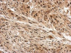 Invitrogen DDB1 Polyclonal Antibody 100 &mu;L; Unconjugated:Antibodies,
