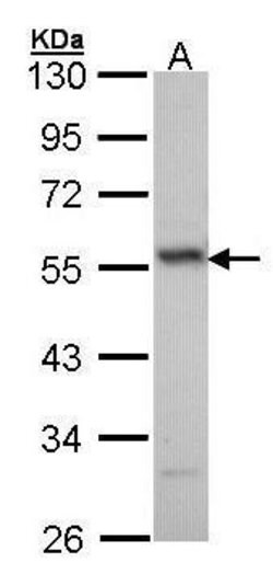 Invitrogen ERG Polyclonal Antibody 100 &mu;L | Buy Online | Invitrogen&trade; | Fisher Scientific