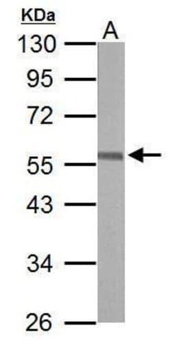 Invitrogen ERG Polyclonal Antibody 100 &mu;L | Buy Online | Invitrogen&trade; | Fisher Scientific