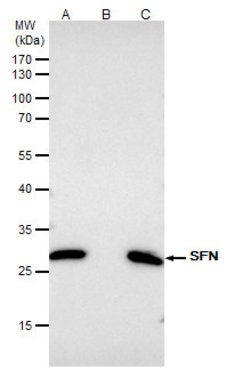 Invitrogen 14-3-3 sigma Polyclonal Antibody 100 &mu;L | Buy Online | Invitrogen&trade; | Fisher Scientific