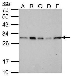 Invitrogen 14-3-3 sigma Polyclonal Antibody 100 &mu;L | Buy Online | Invitrogen&trade; | Fisher Scientific