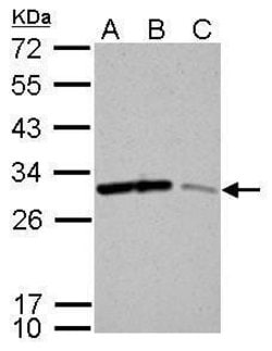 Invitrogen 14-3-3 sigma Polyclonal Antibody 100 &mu;L | Buy Online | Invitrogen&trade; | Fisher Scientific