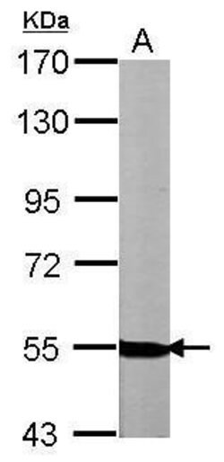 Invitrogen NRG1 Polyclonal Antibody 100 &mu;L; Unconjugated:Antibodies,