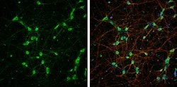 Invitrogen NEFL Polyclonal Antibody 100 &mu;L; Unconjugated:Antibodies,