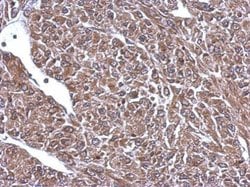 Invitrogen NEFL Polyclonal Antibody 100 &mu;L; Unconjugated:Antibodies,