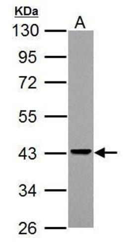 Invitrogen™ Adenosine Deaminase Polyclonal Antibody