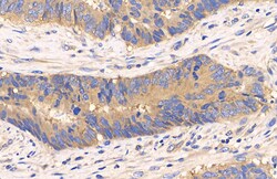 Invitrogen mTOR Polyclonal Antibody 100 &mu;L; Unconjugated:Antibodies,