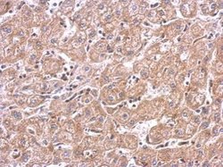 Invitrogen mTOR Polyclonal Antibody 100 &mu;L; Unconjugated:Antibodies,
