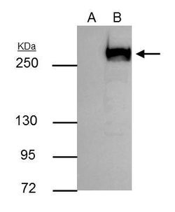 Invitrogen mTOR Polyclonal Antibody 100 &mu;L; Unconjugated:Antibodies,