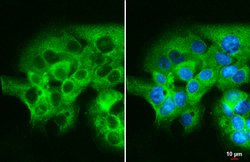 Invitrogen mTOR Polyclonal Antibody 100 &mu;L; Unconjugated:Antibodies,