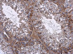 Invitrogen mTOR Polyclonal Antibody 100 &mu;L; Unconjugated:Antibodies,