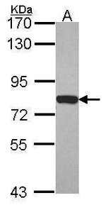 Moesin Polyclonal Antibody, Invitrogen 100 μL; Unconjugated