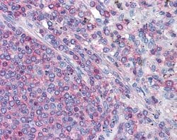 Invitrogen gamma Actin Polyclonal Antibody 100 &mu;L; Unconjugated:Antibodies,