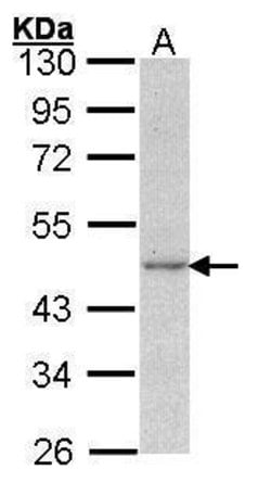 Invitrogen gamma Actin Polyclonal Antibody 100 &mu;L; Unconjugated:Antibodies,