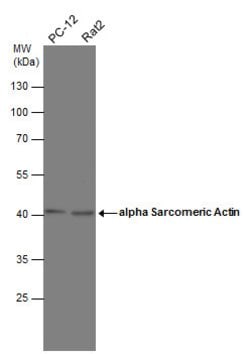 Invitrogen gamma Actin Polyclonal Antibody 100 &mu;L; Unconjugated:Antibodies,