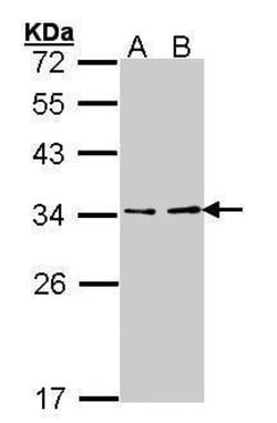 Invitrogen V-ATPase E1 Polyclonal Antibody 100 &mu;L | Buy Online | Invitrogen&trade; | Fisher Scientific