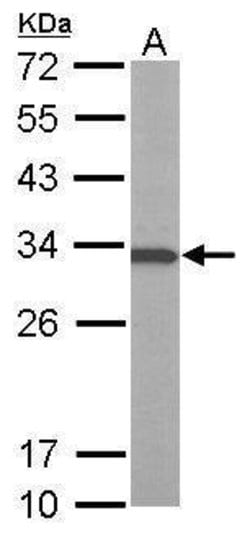 Invitrogen V-ATPase E1 Polyclonal Antibody 100 &mu;L | Buy Online | Invitrogen&trade; | Fisher Scientific