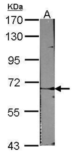 Invitrogen ACVRL1 Polyclonal Antibody 100 &mu;L | Buy Online | Invitrogen&trade; | Fisher Scientific