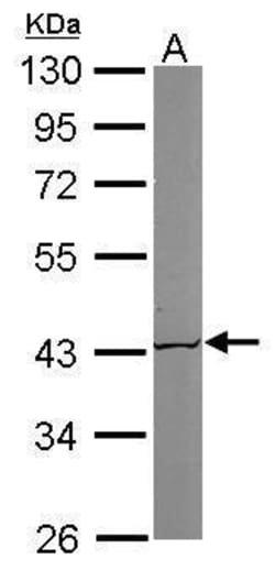 Invitrogen ACAT1 Polyclonal Antibody 100 &mu;L; Unconjugated:Antibodies,