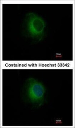 Invitrogen Plasminogen Polyclonal Antibody 100 &mu;L; Unconjugated:Antibodies,