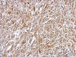 Plasminogen Polyclonal Antibody:Antibodies, Polyclonal
