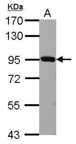 Plasminogen Polyclonal Antibody:Antibodies, Polyclonal