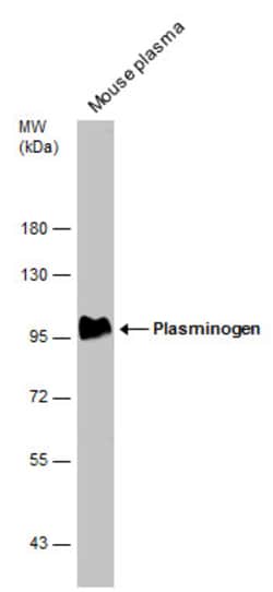 Plasminogen Polyclonal Antibody:Antibodies, Polyclonal