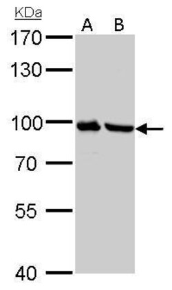 Plasminogen Polyclonal Antibody:Antibodies, Polyclonal